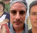 Lembra dele? Ex-Galã de Malhação faz mudança radical no rosto aos 51 anos e resultado surpreende; veja antes e depois