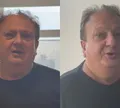 Angioplastia: entenda procedimento realizado por Erick Jacquin após internação às pressas
