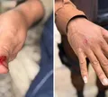 Macaco invade condomínio na Bahia, ingere álcool e remédios, e deixa feridos após ataque