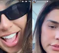 Simone Mendes choca marido com nova cirurgia no nariz; VÍDEOS