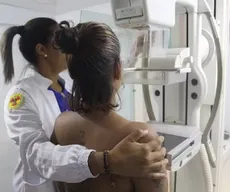 Cerca de 40 mil mamografias gratuitas serão ofertadas em Salvador; veja como agendar