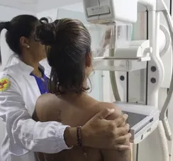 Cerca de 40 mil mamografias gratuitas serão ofertadas em Salvador; veja como agendar