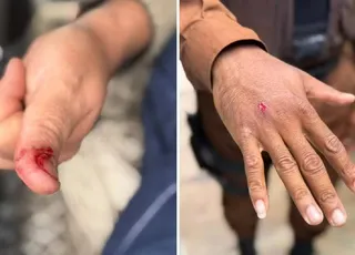 Macaco invade condomínio na Bahia, ingere álcool e remédios, e deixa feridos após ataque