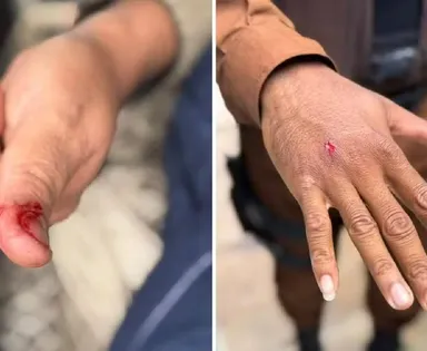 Macaco invade condomínio na Bahia, ingere álcool e remédios, e deixa feridos após ataque