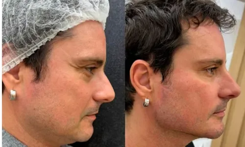 
					Lembra dele? Ex-Galã de Malhação faz mudança radical no rosto aos 51 anos e resultado surpreende; veja antes e depois
				
				