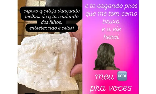 
					Luana Piovani expõe piolhos e machucados em filhos e detona Scooby
				
				