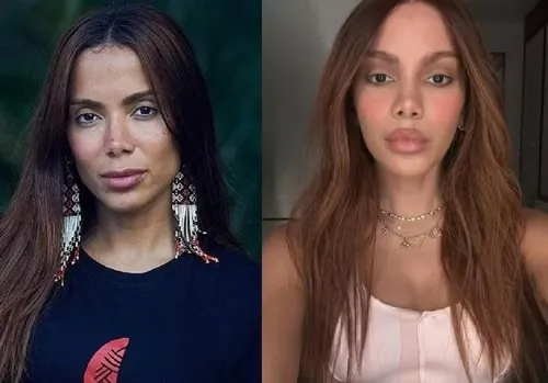
					Antes e depois de Anitta em Paris choca web; veja os procedimentos que a cantora já assumiu e quanto custam
				
				