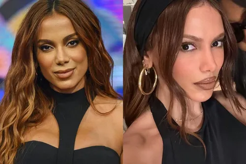 
					Antes e depois de Anitta em Paris choca web; veja os procedimentos que a cantora já assumiu e quanto custam
				
				