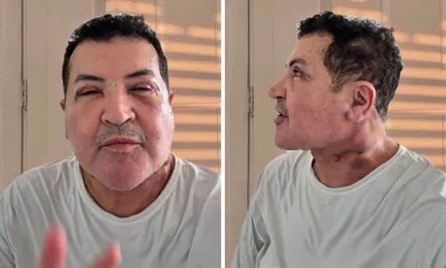 
					Beto Barbosa reaparece após cirurgia plástica no rosto aos 71 anos; VÍDEO
				
				