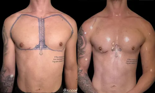 
					Du Cutox à lipo: Rico Melquíades choca com mais de 20 procedimentos estéticos no corpo; veja lista
				
				