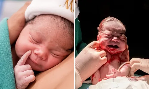 
					Sheuba e Tiago Souza mostram rosto da 1ª filha após parto induzido
				
				