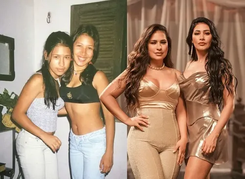 
					Simone Mendes irreconhecível: o antes e depois da cantora até o procedimento no nariz que viralizou
				
				