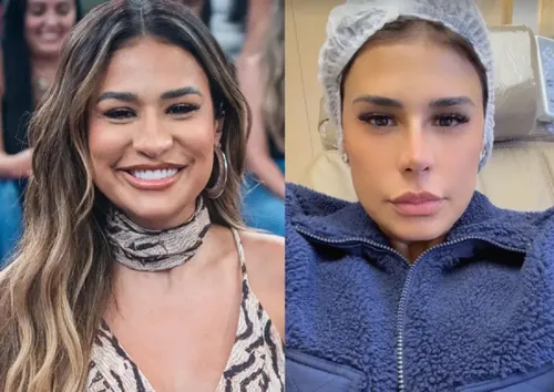 
					Simone Mendes irreconhecível: o antes e depois da cantora até o procedimento no nariz que viralizou
				
				