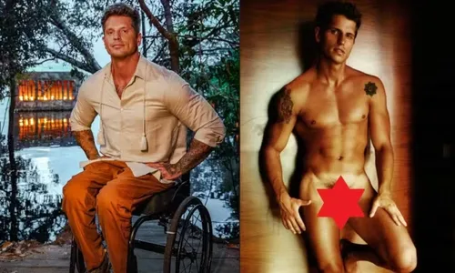 
					Vida sexual de Fernando Fernandes após acidente é exposta e nudes voltam a viralizar na web
				
				