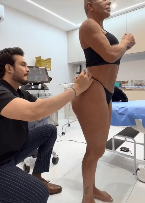 
					Entenda como é o tratamento feito por Gretchen contra flacidez no rosto, bumbum e pernas; resultado impressiona
				
				