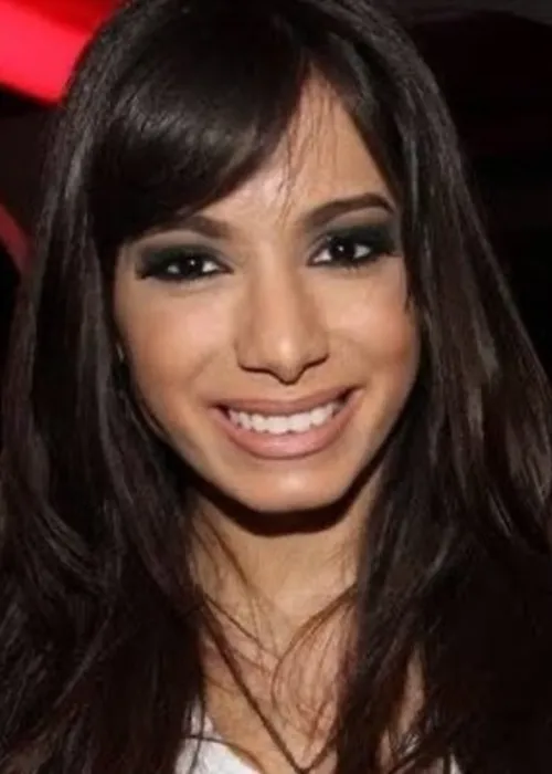 
					Antes e depois de Anitta em Paris choca web; veja os procedimentos que a cantora já assumiu e quanto custam
				
				