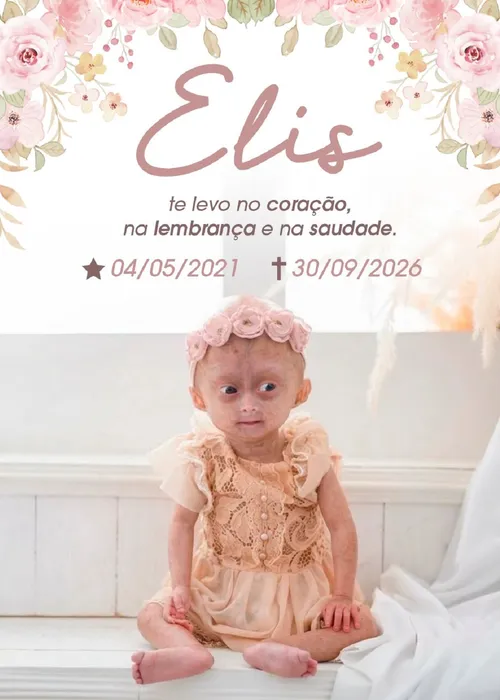 
					Quem era Elis, uma das gêmeas brasileiras diagnosticadas com síndrome rara que morreu aos 5 anos
				
				