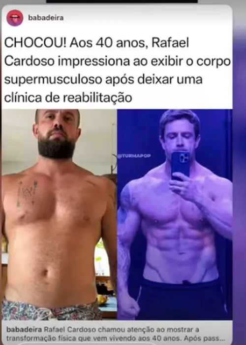 
					Rafael Cardoso surge irreconhecível após reabilitação; veja fotos
				
				