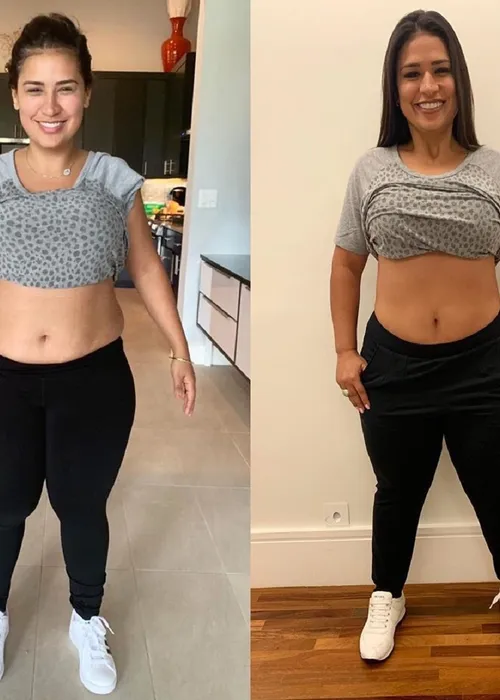 
					Simone Mendes irreconhecível: o antes e depois da cantora até o procedimento no nariz que viralizou
				
				