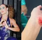
                  Dança dos Famosos: Bruna Griphao assusta ao mostrar braço machucado