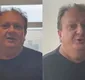 
                  Angioplastia: entenda procedimento realizado por Erick Jacquin após internação às pressas