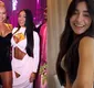 
                  Melhor amiga de Virginia Fonseca, Duda Freire, faz harmonização no bumbum para corrigir uma deformação por celulite