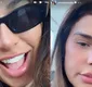 
                  Simone Mendes choca marido com nova cirurgia no nariz; VÍDEOS