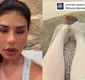 
                  Simone Mendes entrega que fez 'lifting de coxa', cirurgia que custa até R$ 25 mil: 'Sempre tive vergonha'