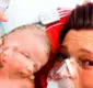 
                  Mulher dá à luz a gêmeas siamesas na Austrália