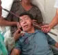 
                  Barra de metal atravessa cabeça, mas homem sobrevive após operar