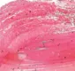 
                  Testamos: açúcar esfoliante de Pitaya