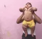 
                  Bebê de 10 meses tem peso de criança de 6 anos; assista vídeo