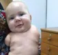 
                  História de bebê sem braços e pernas comove internautas