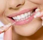 
                  Passar fio dental pode não ser tão eficaz contra a cárie