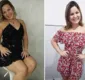 
                  Ex-BBB comemora 7kg a menos e fala sobre lipo e silicone