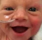 
                  Emocionante! Bebê prematuro sorri e foto viraliza na web