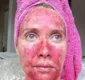 
                  Viciada em bronzeamento mostra terrível resultado de abuso do sol