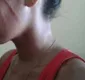 
                  Jovem é agredida e tem cabelo cortado por três mulheres na Bahia
