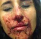 
                  Foliona é agredida após reclamar de 'apalpada' durante Carnaval