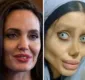 
                  Iraniana faz 50 cirurgias para ficar parecida com Angelina Jolie