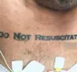
                  Tatuagem 'não ressuscite' em paciente deixa médicos em dúvida