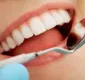 
                  Faculdade oferece atendimento odontológico gratuito