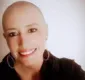 
                  Diretora de escola diz que imagem de mãe com câncer é agressiva