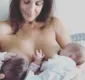 
                  Ivete revela momentos complicados após nascimento das gêmeas