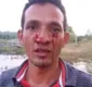 
                  Homem é atacado no rosto por sucuri de três metros