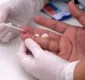 
                  SUS distribuirá autotestes para detectar HIV a partir de 2019