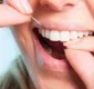 
                  Produto presente em fio dental pode fazer mal à saúde