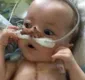 
                  Bebê de nove meses sofre 25 paradas cardíacas em um dia