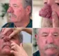 
                  Avô recorre a especialista para mudar nariz que 'assusta os netos