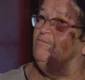 
                  Idosa de 63 anos é arrastada por carro e diz: 'não tenho raiva'